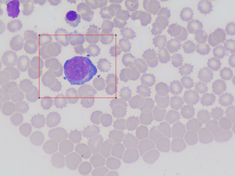 原始粒细胞与原始红细胞