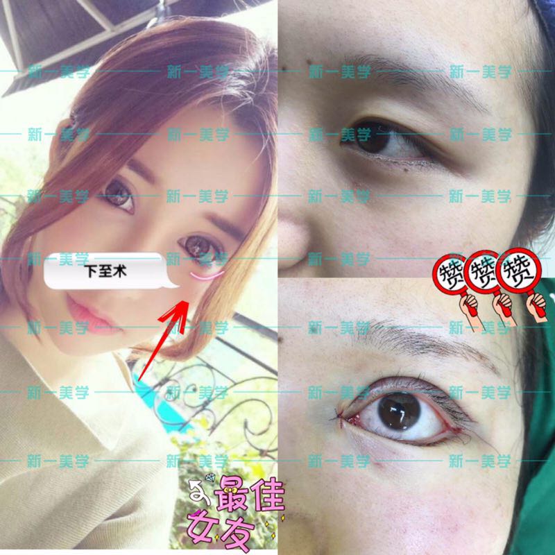 一美·南山整形培訓中心招生報名啦～