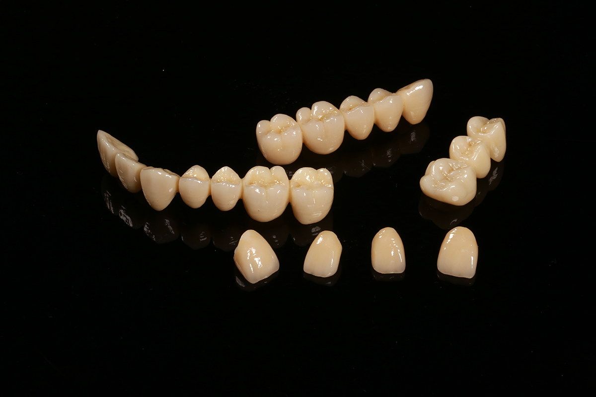 金迎义齿产品展示