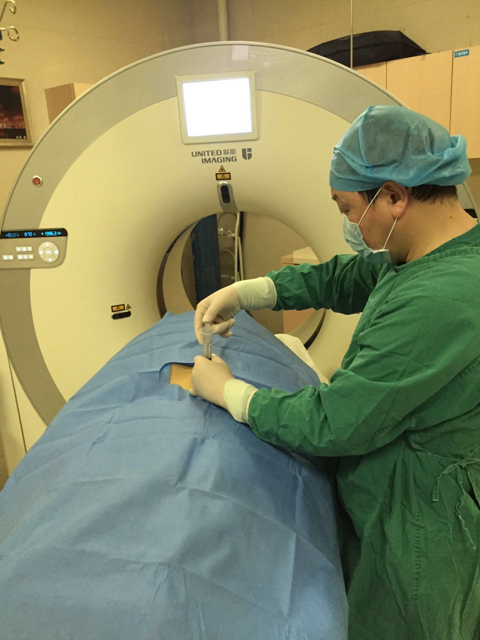 ct引导下经皮胃造瘘